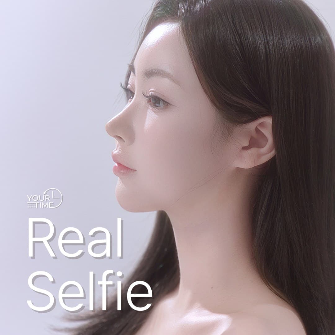 유어타임성형외과 리얼셀피 — 코재수술
