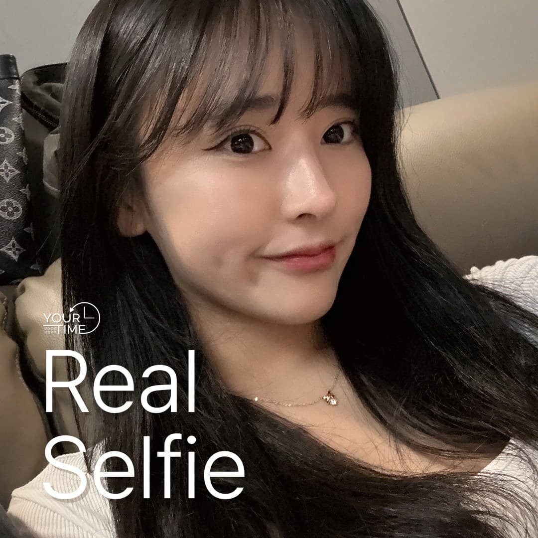 유어타임성형외과 리얼셀피 — 첫코성형