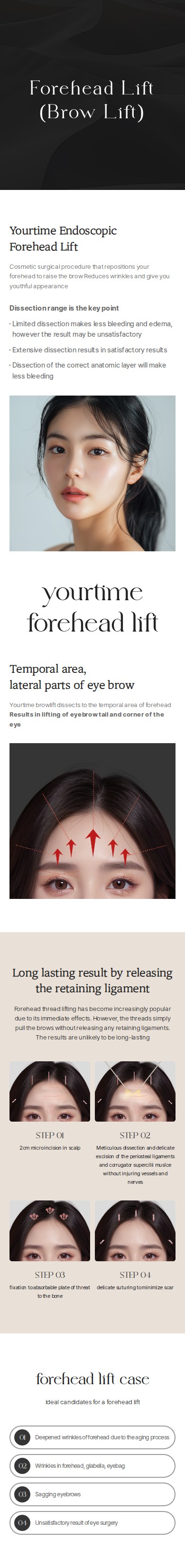 Forehead Lift (Brow Lift)