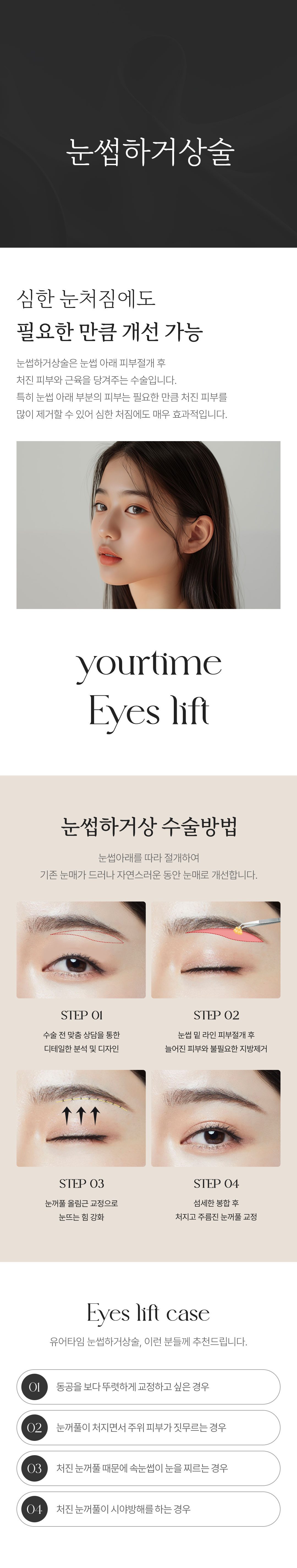눈썹하거상 안내