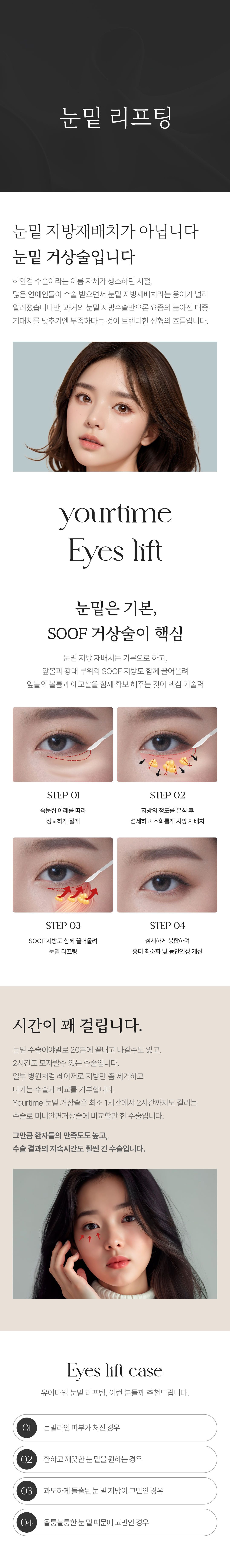 눈밑 리프팅(하안검) 안내