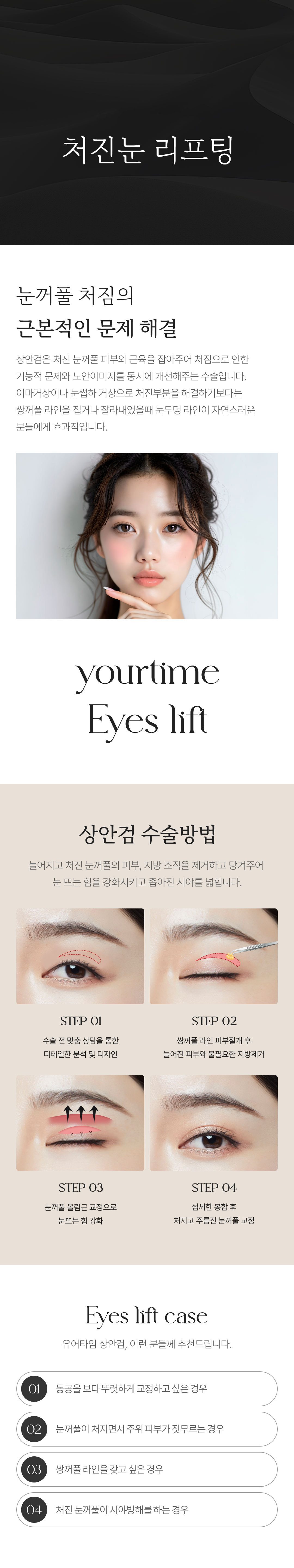 처진눈 리프팅(상안검) 안내