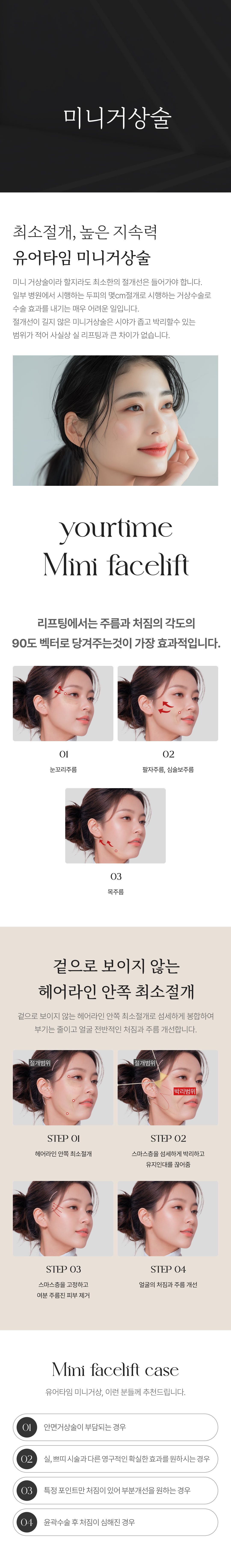 미니거상술 안내